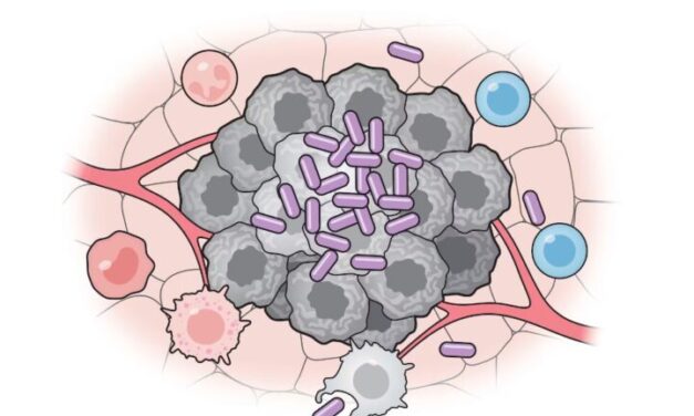 Vacuna que logró suprimir con éxito la metástasis de cáncer